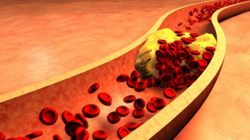 Si të pastroni gjakun nga yndyra?
