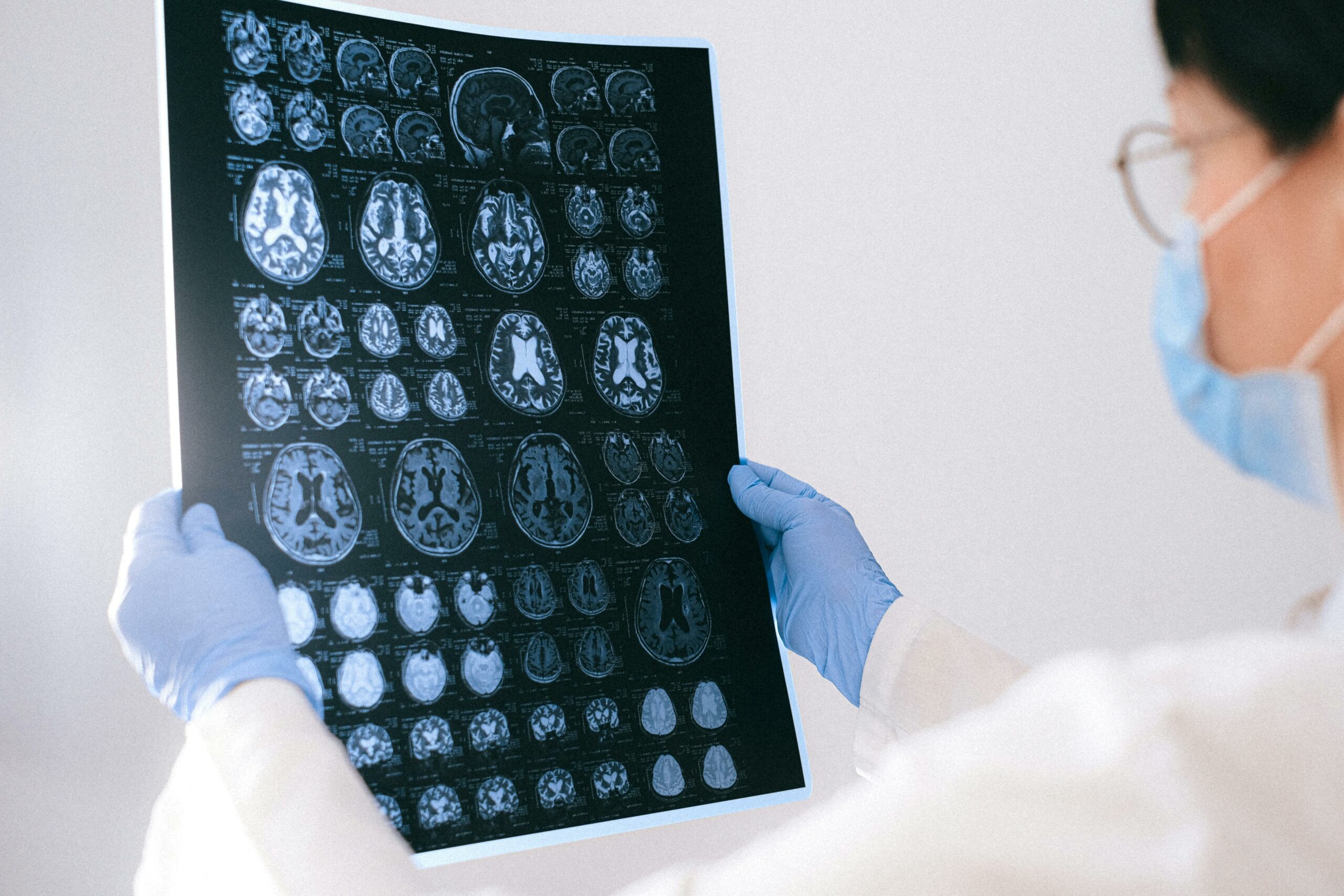Regjistrimet e marra para operacionit tregojnë se si truri i njeriut planifikon dhe prodhon të folur