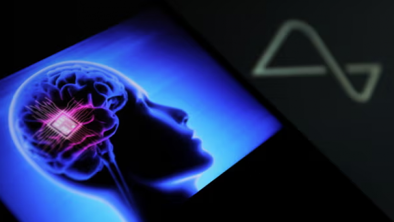 Implanti i parë njerëzor i Neuralink ka filluar të shkëputet nga truri i pacientit