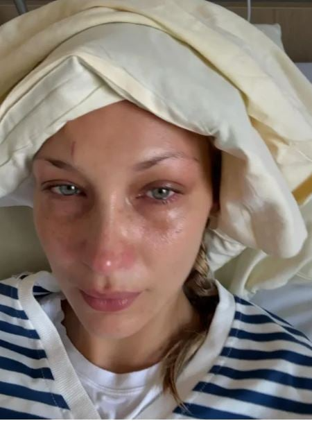 Në luftë me sëmundjen, Bella Hadid ndan foto tronditëse nga spitali. Ja mesazhi i Gigi-t