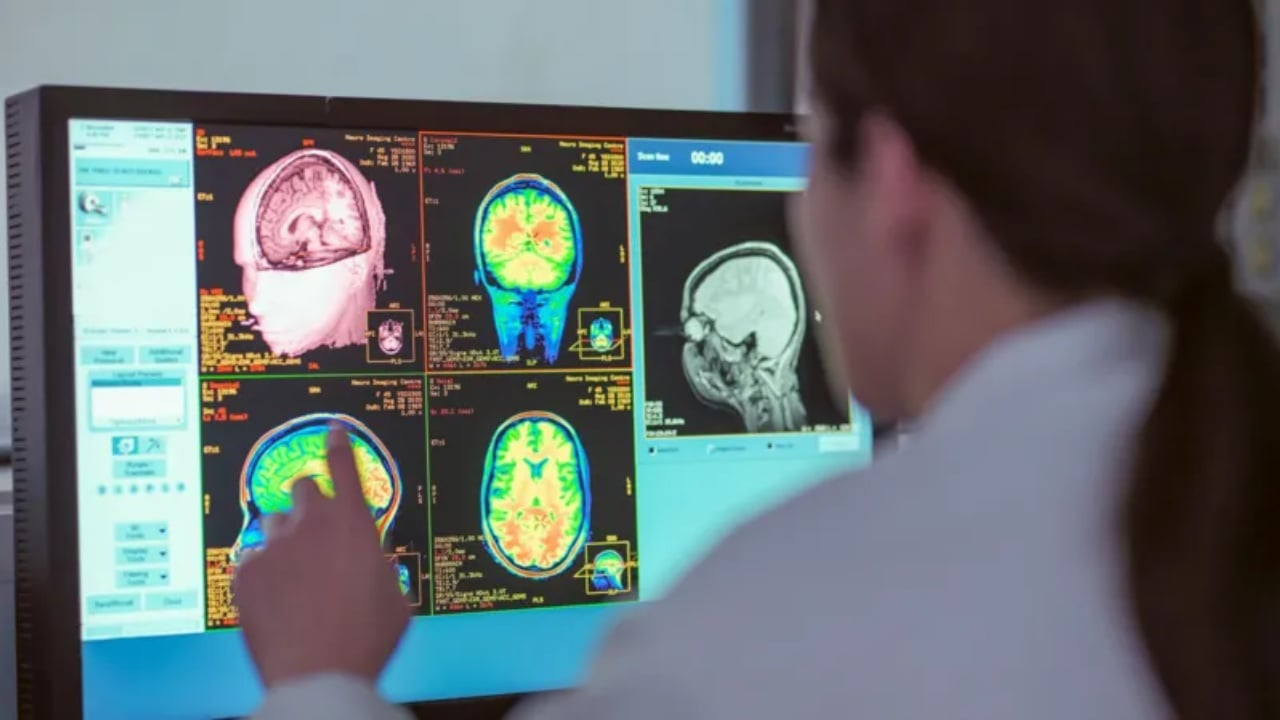 adoleshenca-zgjat-deri-ne-te-30-at-studimi-i-ri-identifikon-kater-mosha-kyce-te-zhvillimit-te-trurit