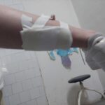 Kumanovë, 17 vjeçarja sulmohet nga qentë endacak